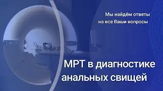 МРТ в диагностике анальных свищей