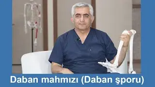 Daban mahmızının müalicəsi ( Daban şporu)