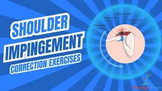 Shoulder Impingement correction exercises