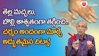 Bolli, Vitiligo | తెల్ల మచ్చలు బొల్లి శాశ్వతంగా తగ్గించే! Dr. Ch Madhusudana Sarma | TeluguOneHealth