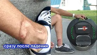 Про трамвы на моноколесе которые вы получите пока учитесь кататься на моноколесе