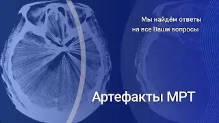 Артефакты МРТ