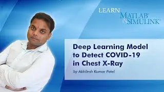 Deep Learning Model to Detect COVID-19 on Chest X-ray using MATLAB