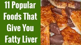 11 Foods That Give You Fatty Liver (High Fructose Foods)