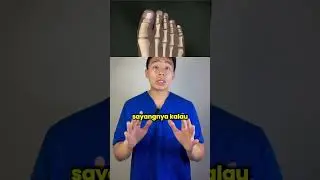 Jempol bengkok dan nyeri? Ciri penyakit bunion! 