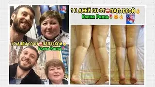 ЖИЗНЬ БЕЗ ТАБЛЕТОК И БОЛЕЙ. ЕЛЕНА РИТА ДЕНЬ В СТОПАПТЕКЕ! ОТЗЫВ ПОСЛЕ ФИЗИОПРАКТИКИ