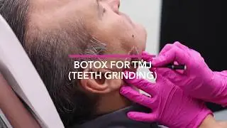 Botox for TMJ (Teeth Grinding) with Nurse Angella