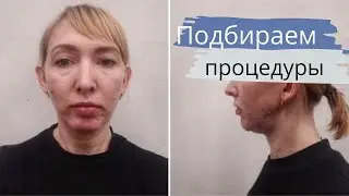 КОСМЕТОЛОГ против ХИРУРГА 2 / Подбираем ПРОЦЕДУРЫ для подписчицы  / 