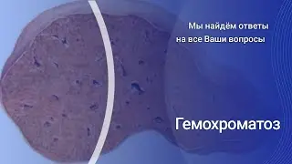 Гемохроматоз