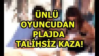 Ünlü Oyuncudan Plajda Talihsiz Kaza!