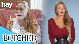 Pixee Wants To Be A Living Cartoon | Season 5 | Botched