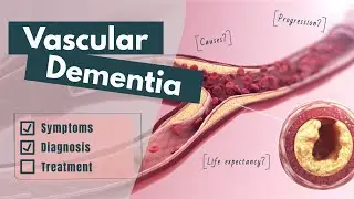 What is vascular dementia? | Causes, symptoms, diagnosis, treatment & prognosis