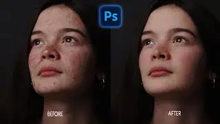 Photoshop Skin Retouching Tutorial | High-End-Skin Softening in Photoshop 