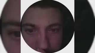 АНАРУ СЛОМАЛИ НОС - anarabdullaev
