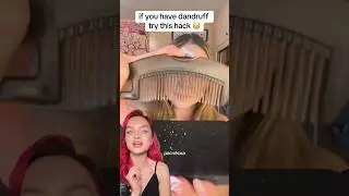 ЧУДО РАСЧЕСКА ОТ ПЕРХОТИ😱КИТАЙСКИЙ БЬЮТИ СЕКРЕТ😳#перхоть  #расческа #aliexpress #wildberries