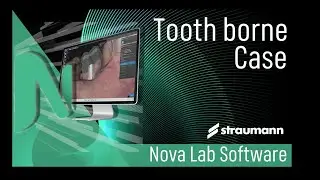 Set up a tooth borne case with Straumann Design Lab Software