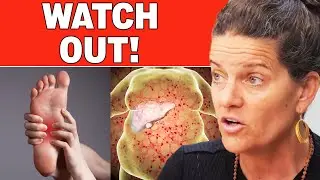 Your Body Is Trying To Warn You Of Liver Problems! - Spot This Early On | Dr. Mindy Pelz