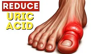 🚫🩺 9 SECRET Foods to Outsmart URIC ACID Naturally