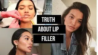 GETTING MY LIPS DONE VLOG