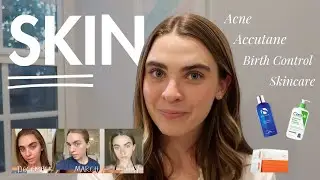 How I Cleared My Skin - Hormonal Acne, Accutane, Cystic Acne, & more.