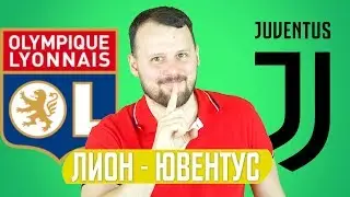 ЛИОН - ЮВЕНТУС / ПРОГНОЗ ЛИГА ЧЕМПИОНОВ