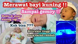 CARA MERAWAT BAYI KUNING !!