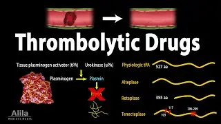 Pharmacology: Thrombolytic (Fibrinolytic) Drugs, Animation