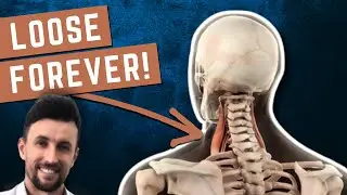 How to Permanently Loosen Tight Scalenes