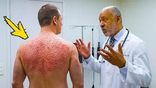The man thought he had bedbugs. The doctor took a closer look and was horrified!