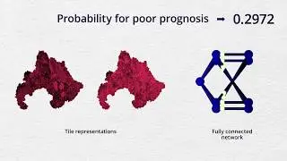 Deep learning for prediction of colorectal cancer outcome: a discovery and validation study