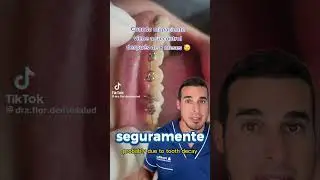 Cuando no acudes a tus REVISIONES de ORTODONCIA - Esto le ocurrió
