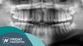 Friday Favorite: How to Treat Periodontitis with Diet