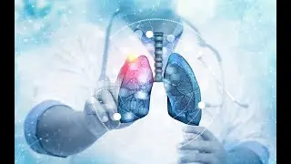 What is Lung Cancer Early Detection?