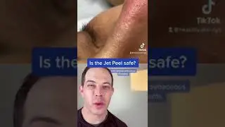 Crazy way to remove blackheads? Jet Peel Demo | 208SkinDoc
