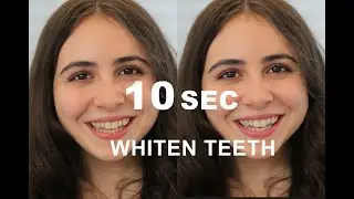 How to Whiten Teeth in 10 Seconds in Photoshop?