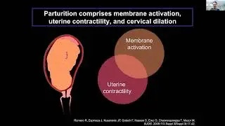 [Kenichiro Motomura] Fetal and maternal NLRP3 signaling is required for preterm labor and birth
