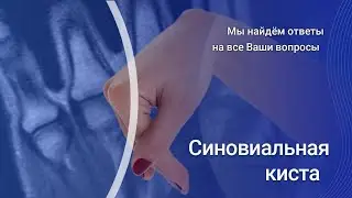 Синовиальная киста