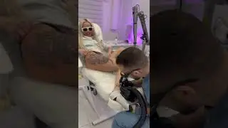 Удаление татуировки без анестезии / с помощью криоустановки