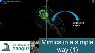 How to segment a particular mask within mimics in a simple way