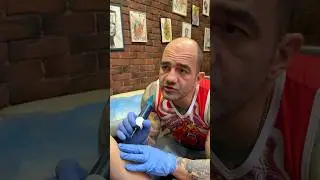 Татуировку ПРИШЛОСЬ удалять ХИРУРГИЧЕСКИ