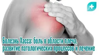 Болезнь Хасса: боль в области плеча, развитие патологических процессов и лечение