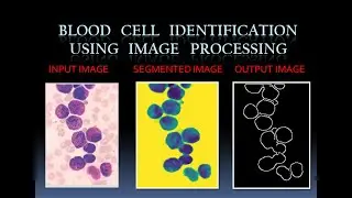 Blood Cell Identification using Image Processing | find and count WBC, RBC using python. Karan Patel