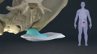 3D Animation of Spinal Medical Equipment -  Medical Device Animation