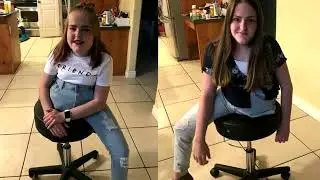 Remember those conjoined twins who were separated 18 years ago? This is what happened to them!