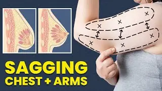 Get Rid of FLABBY ARMS in 1 WEEK at Home (sagging chest & arms) Slim Arm Workout Tighten Loose Skin