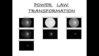 Power transformation in digital image processing | Image enhancement | Medical imaging technique.