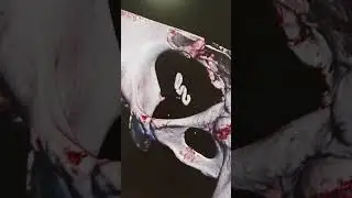 Внутриматочная спираль на КТ
