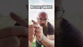 Good news! Finger Recovery Update!