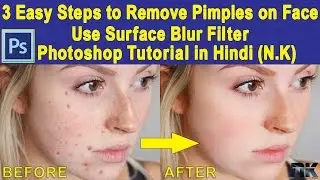 Photoshop Tutorial: 3 Easy Steps to Remove Pimples on Face | Use Surface Blur Filter in Hindi (N.K)