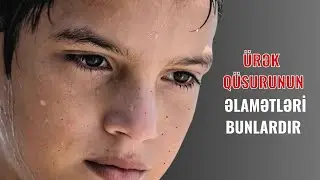 Uşağınızda bu əlamətlər varsa, Ürək qüsuru ola bilər!